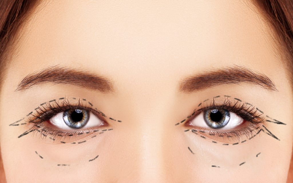 Eyelid surgery and care