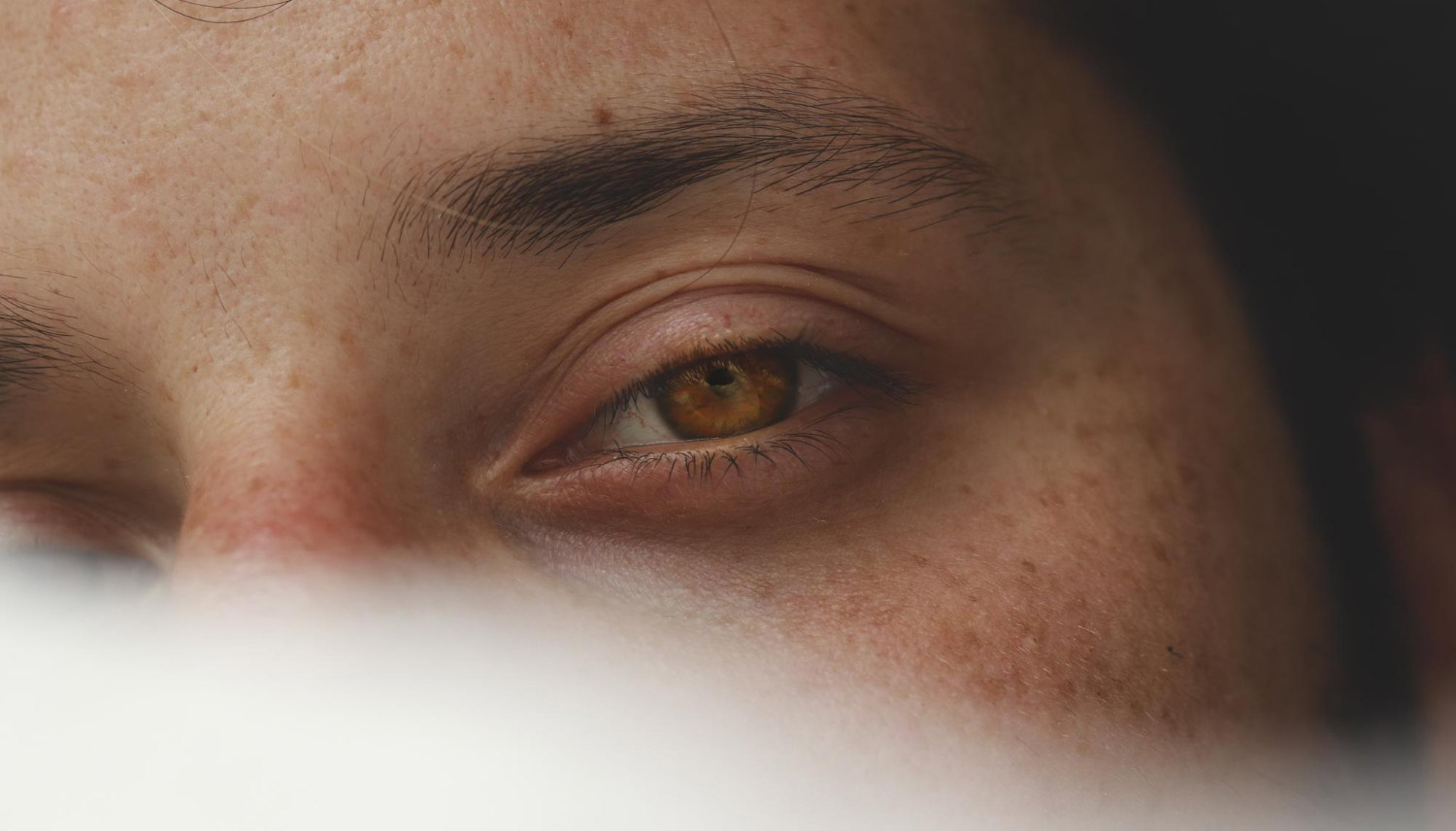 Droopy Eyelids Surgery Singapore