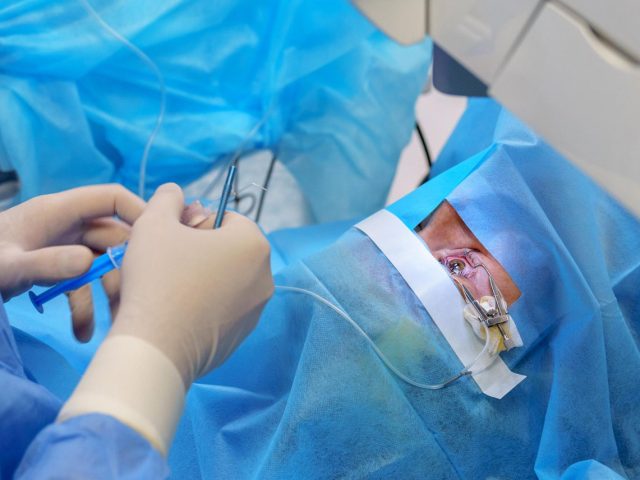 Ectropion and Entropion Surgery Singapore
