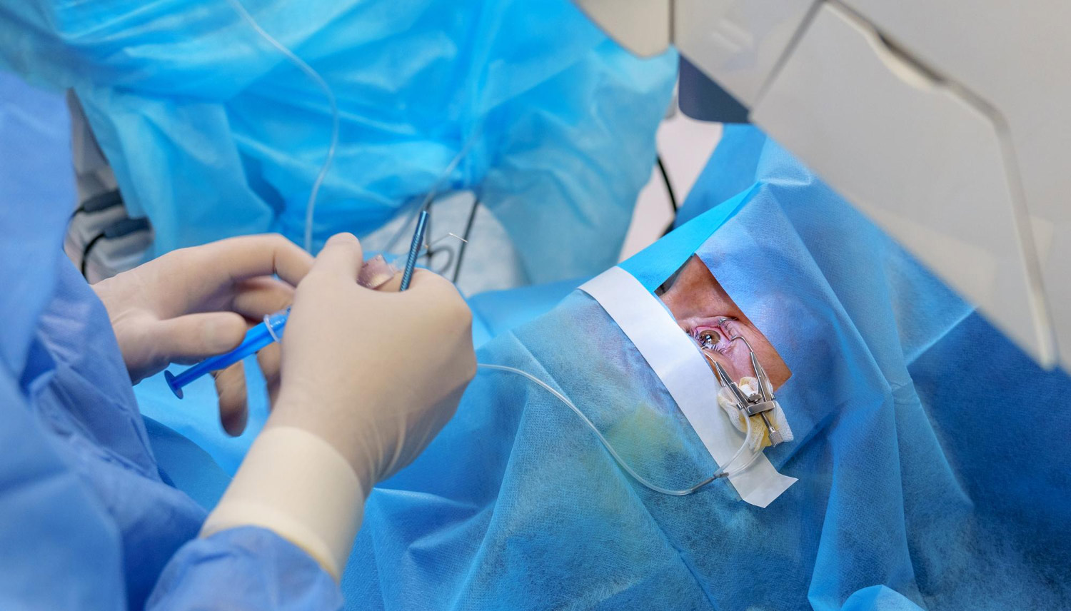 Ectropion and Entropion Surgery Singapore