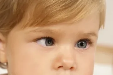 Lazy Eye (Amblyopia) Treatment in Singapore