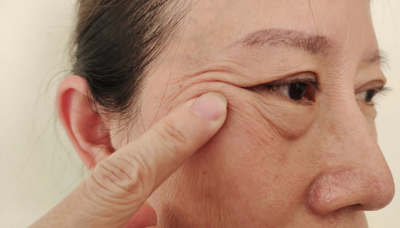 Eyelid Surgery in Singapore: Restoring Vision and Appearance