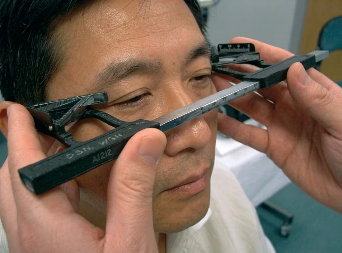 Patient undergoing a Hertel exophthalmometer test to measure proptosis in Singapore during a specialist eye exam.